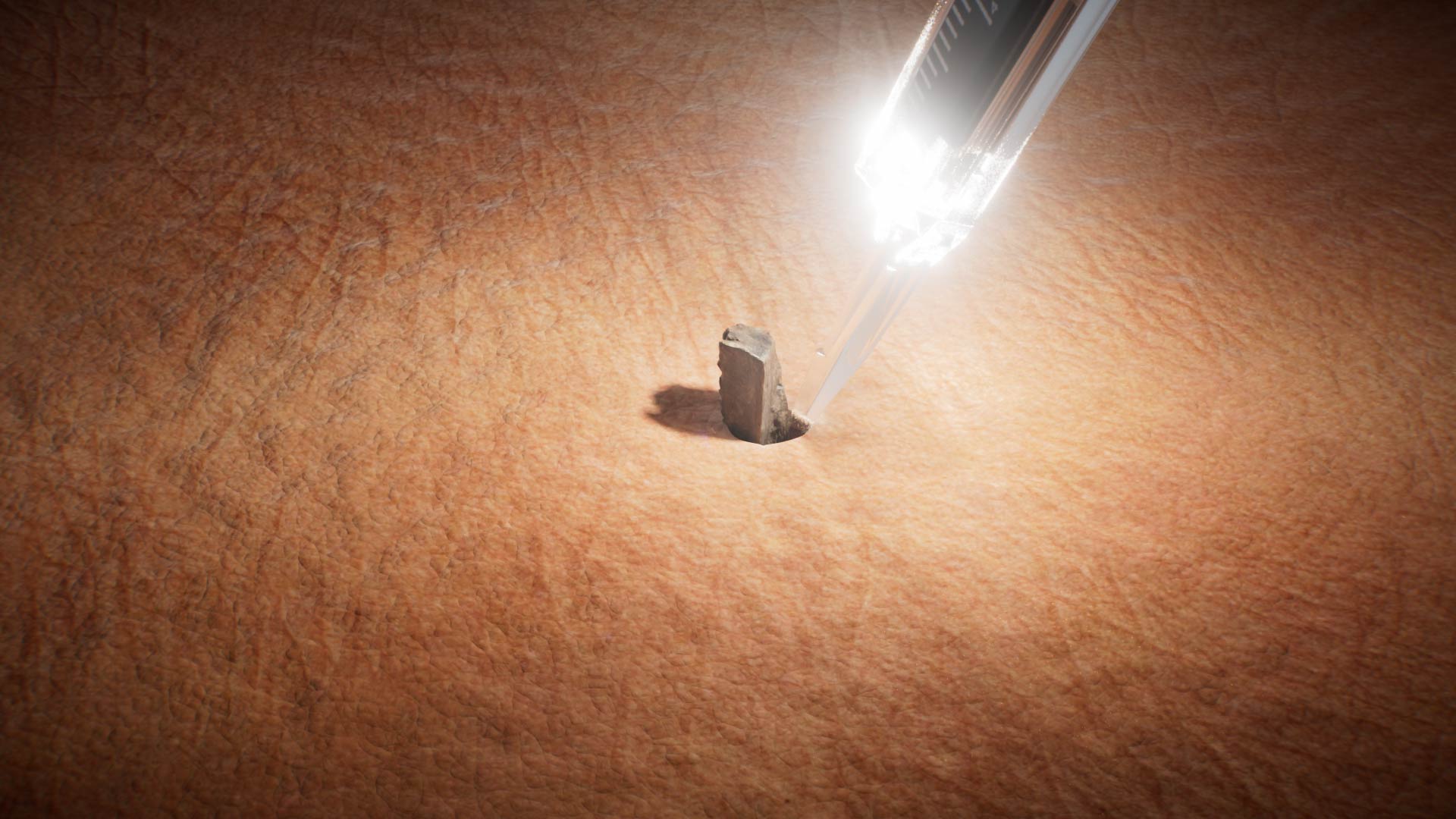 SINGLE USE FOREIGN BODY PROBE LO RES